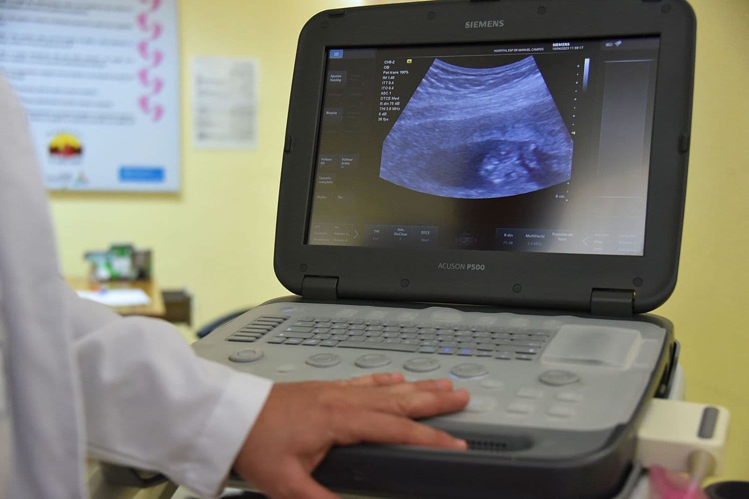 Échographe en service dans un centre de santé : suivi prénatal et données cliniques